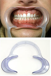 Cheek Retractors Standard (Teenager/Adult) - Each
