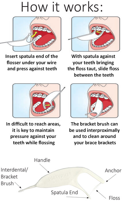 Platypus Orthodontic Flosser